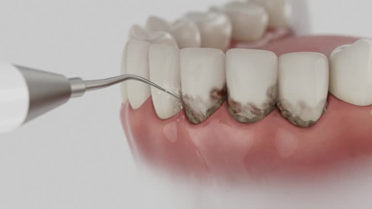 Reliable Emergency Dentist contractor in Festus, MO by Smile Center Dentistry